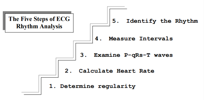 Graphic showing the five steps of ECG rhythm analysis